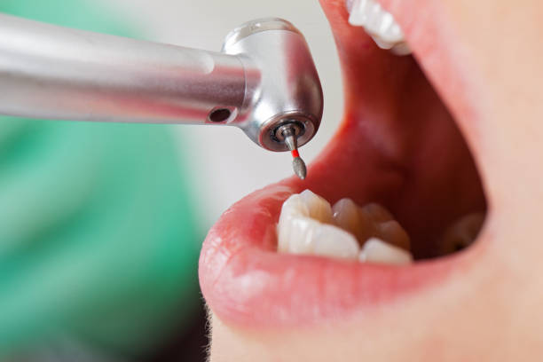 Best Emergency Broken Tooth Repair in Perryopolis, PA